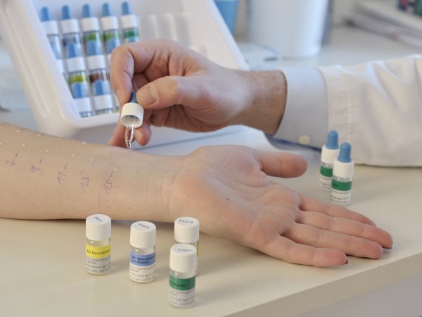 Pricktest zur Allergie Abklärung